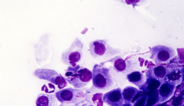 Фото: Норма антител к цитомегаловирусу