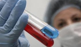 Фото: Симптомы кандидоза