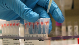 Фото: Инкубационный период трихомониазa